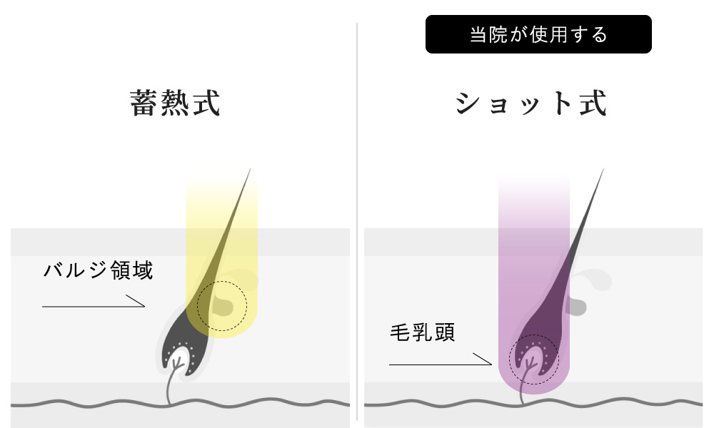 医療レーザーが破壊するターゲット